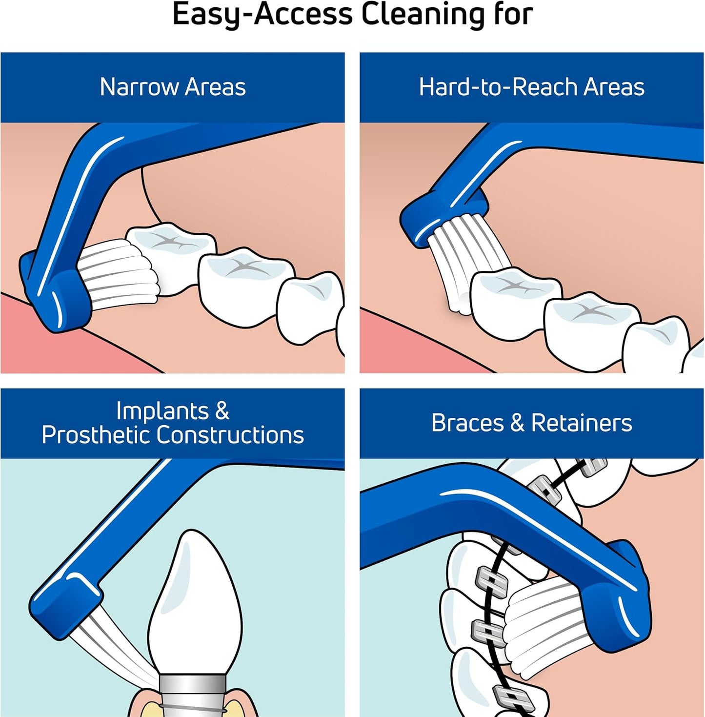TePe Universal Care Brush – 1pc – Precision Cleaning for Braces & Implants