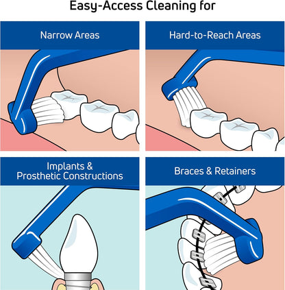 TePe Universal Care Brush – 1pc – Precision Cleaning for Braces & Implants